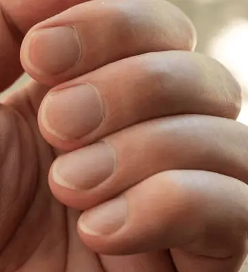 A close up of a person's hand

showing a rounded manicure  mens nail care